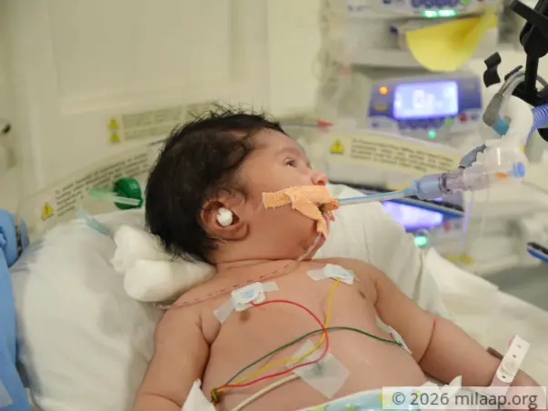 Orphanage Teacher Struggles To Save 10-Day-Old Who Cannot Eat