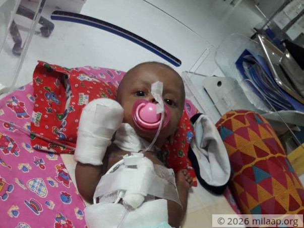 4-months old Baby of Nancy needs your support to undergo his treatment