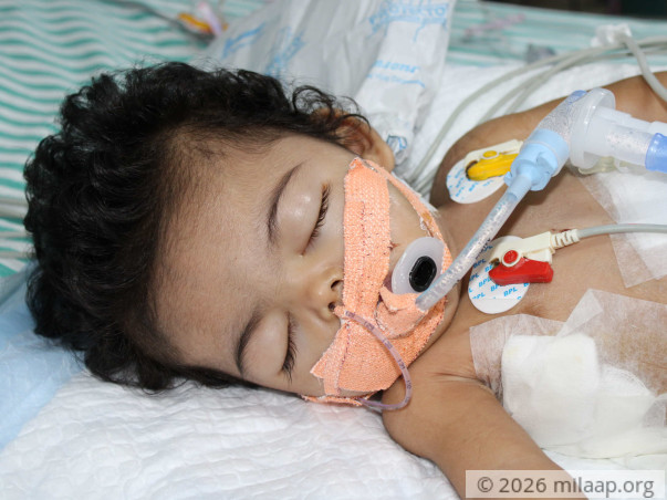 Baby Girl Who Can't Eat Or Breathe Needs Urgent Help To Live