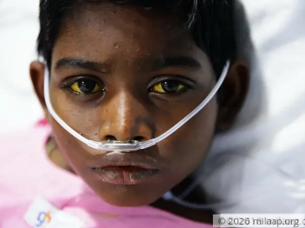 Support Deva to undergo Liver transplant surgery