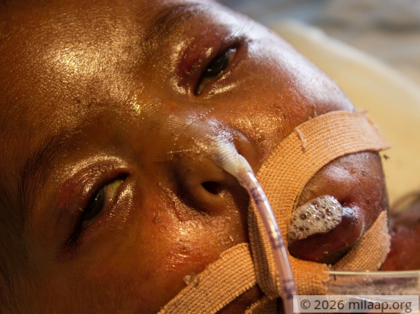 2-Month-Old Who Suffered A Deadly Cardiac Arrest Needs Urgent Help