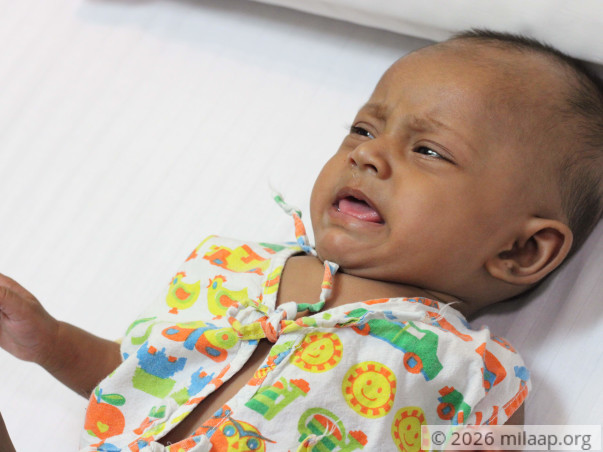 Poor Mother Cannot Save 4-Month-Old Baby From Severe Heart Disease