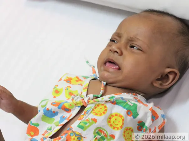 Poor Mother Cannot Save 4-Month-Old Baby From Severe Heart Disease