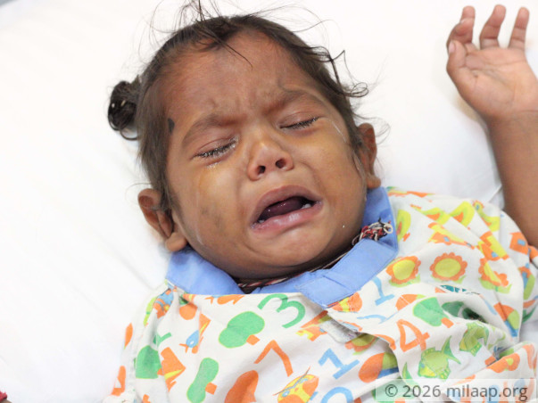 Every Breath Is A Struggle For This Baby Who Needs Open Heart Surgery