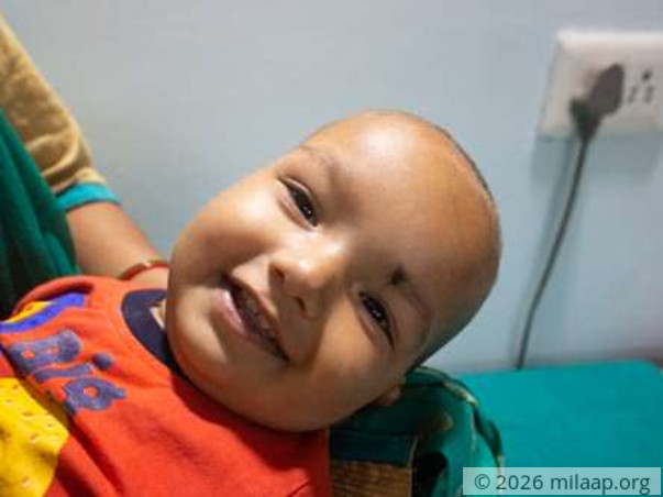 9-Month-Old Whose Breathlessness Doesn't Let Him Sleep Beyond 15 Mins