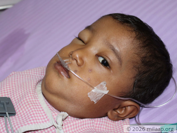 3-Year-Old Will Suffocate To Death If His Chest Tumor Is Not Removed