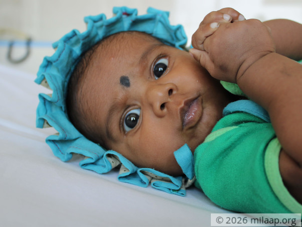 Only An Open Heart Surgery Will Save This 4-Month-Old's Life