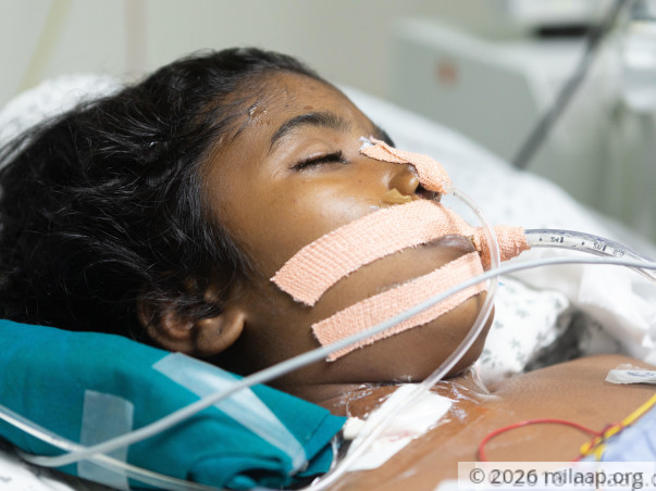 This Girl's Vital Organs Are Failing One By One, Needs Urgent Help