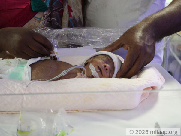 Helpless Mother Is Struggling To Save Premature Baby Born