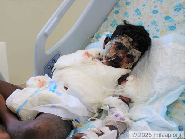 Skin Disease Has Ravaged This Boy's Face And Body, Needs Urgent Help