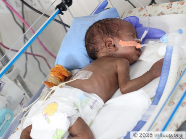 After Losing One Baby, This Couple Now Struggles to Save The Other