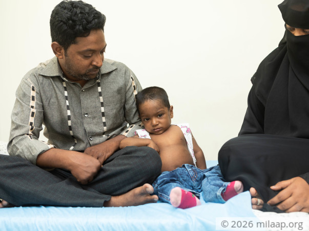 A Rare Disease Has Damaged This 1-Year-Old's Liver, Needs Urgent Help