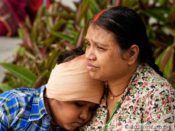 A  Deadly Tumor Has Disfigured This Young Boy's Face, Needs Help