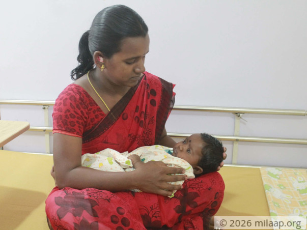 Baby of pavithra needsyour help to undergo the treatment