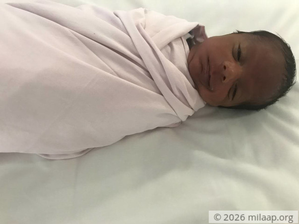1-Month Old Born After Long Wait Will Turn Blind,  Needs  Urgent Help