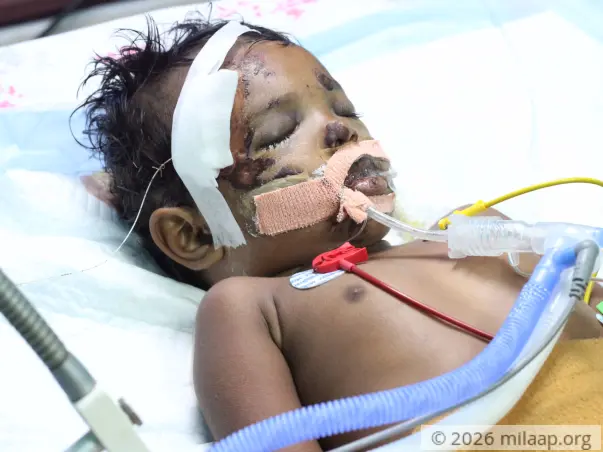 Help 2-Year-Old Who Met With An Accident On Her Way To The Nursery