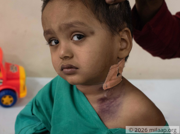 2-Year-Old's Parents Can't Afford The Only Cure For His Rare Disease