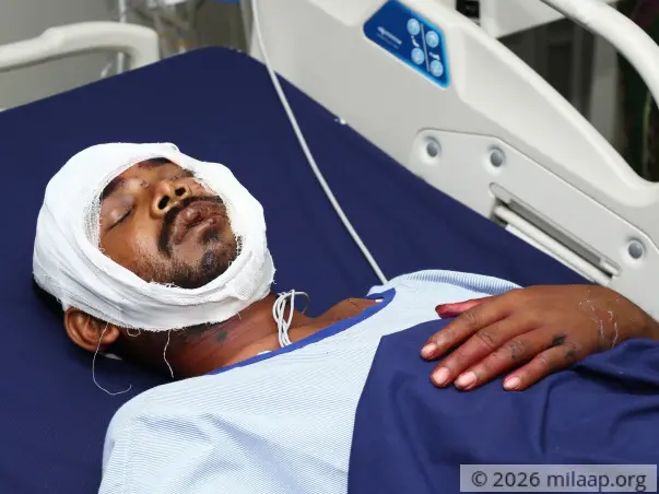 Kunu Kandi needs your help to cure his injury