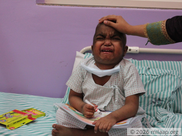 4-Year-Old Will Rare Dangerous Disease Needs Help To Live