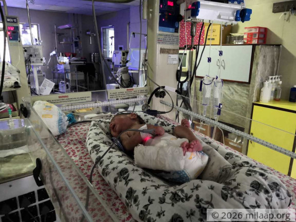 Baby Of Sharmina Ahmed needs your help to survive