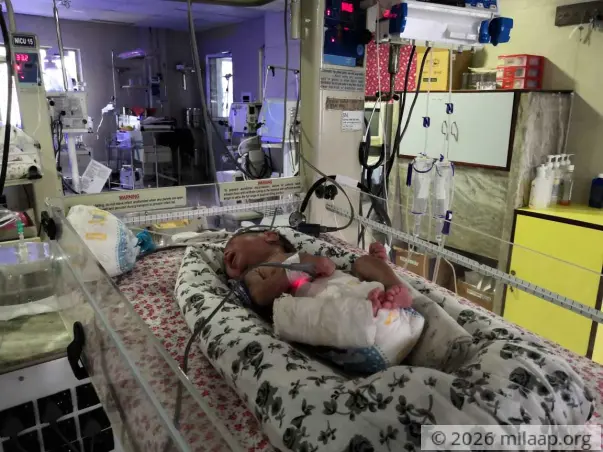 Baby Of Sharmina Ahmed needs your help to survive