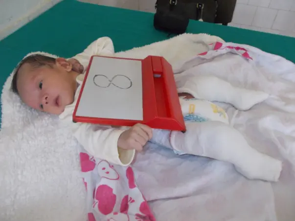 I am fundraising to help treat clubfoot in babies