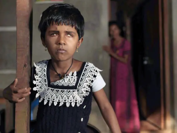 Help Endosulfan affected 32 children in Kasaragod