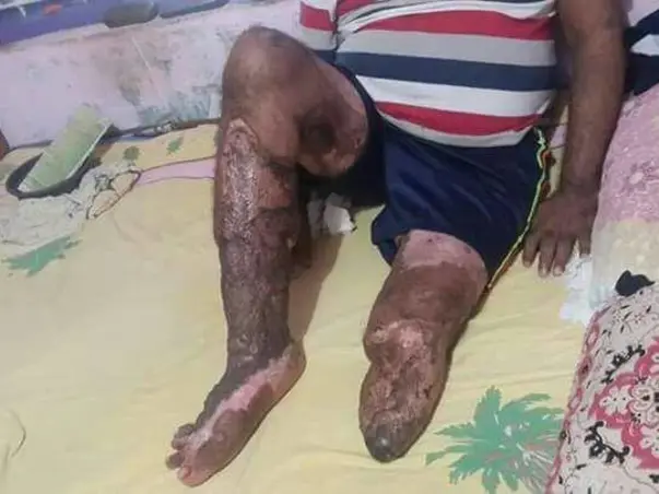 Help the Only Breadwinner of the Family Get Back On His Feet Again