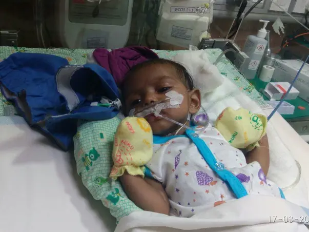 Save Baby Navya From A Serious Heart Condition