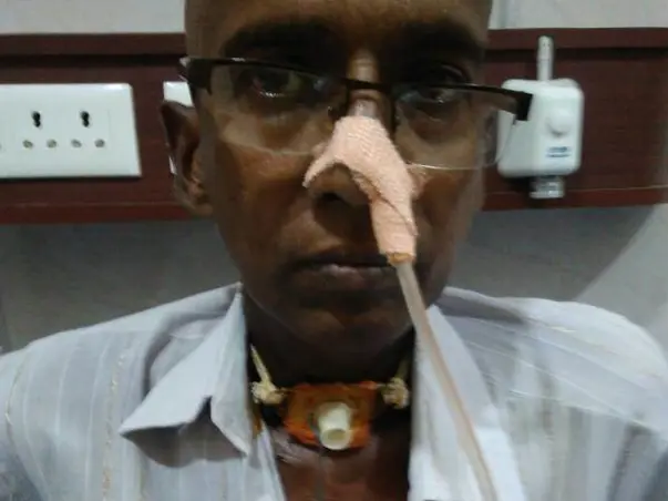Help Narasa Reddy Afford Treatment for Throat Cancer