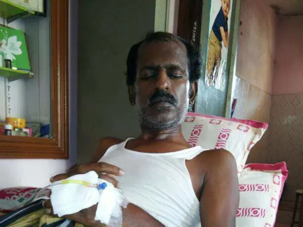 He Has No Stomach Because Of Cancer, Now It Is Attacking His Bones