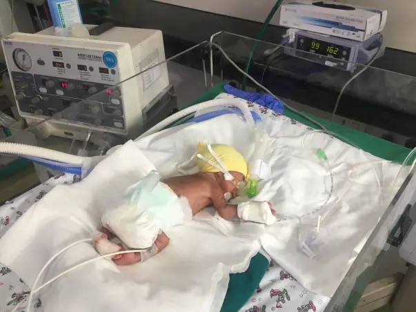 Her Premie Twins Are Struggling To Live And She Has Noone For Support