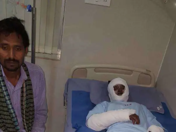 Help Poor Burn Victims from Jharkhand