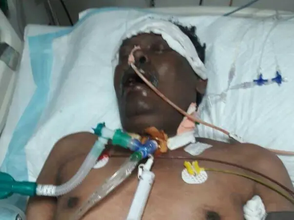Help Madhukar fight septicemia and multi organ dysfunction
