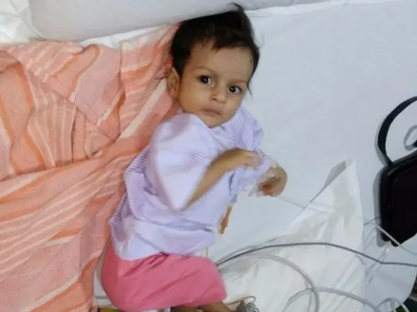 Open heart surgery for 4 months old Baby Girl Shraddha