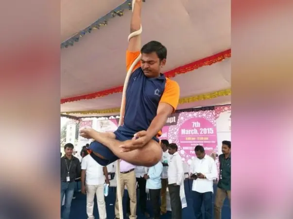 Help This Multi-Talented Man Walk Again With An Artificial Limb.