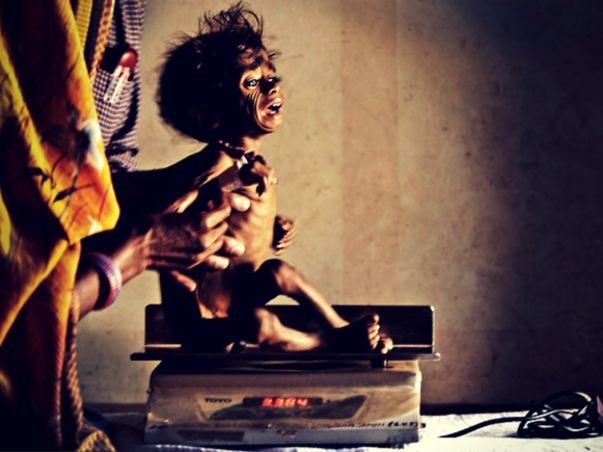 Feed a Tribal Child from Hunger