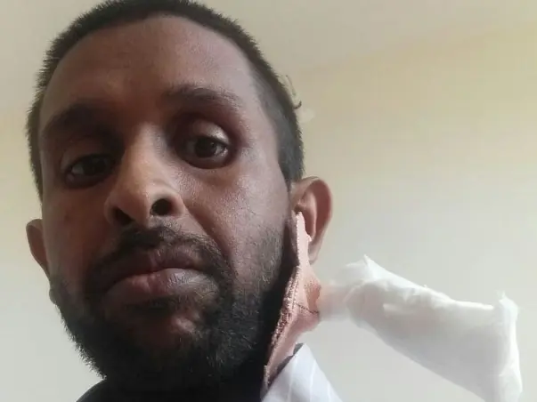 Help Murtuja Undergo Dialysis For His Kidney Failure