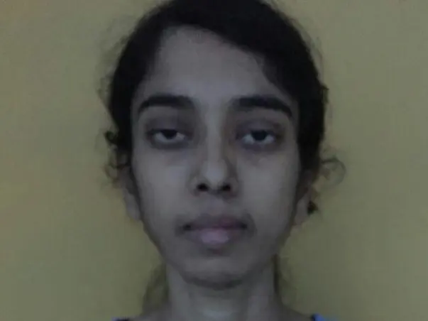 Help My Sister Kokila To Undergo Liver Transplant