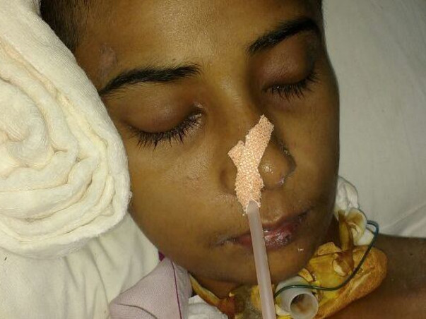 Save Priyanka's Life: Battling "Severe Brain Hemorrhage"