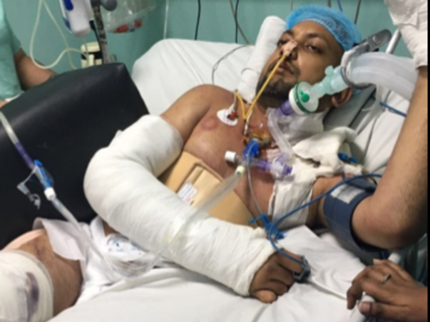 Help Kumar Anand To Fight Against A Severe Brain Injury