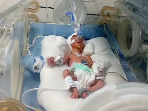 Require Help For New Born-Premature Babies (Twins)
