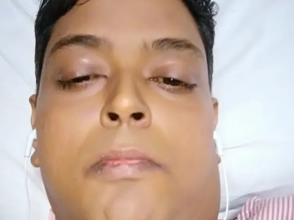 Help mandip get a new liver and a new life