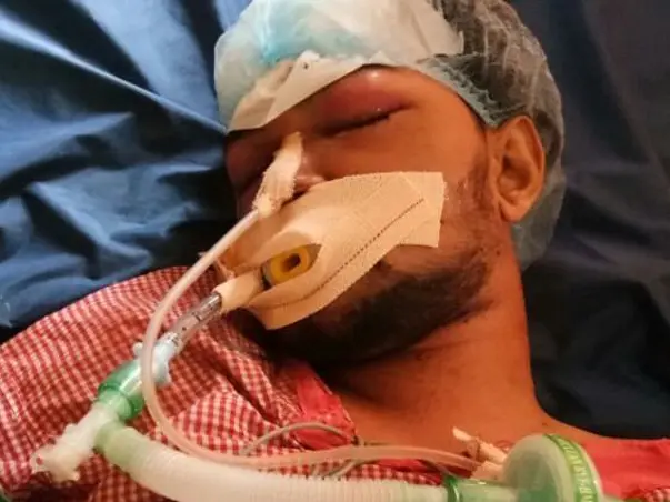 Help Ashwath Sapaliga to Stand Up Again
