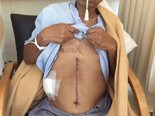 Help Sanjay To Fight Cancer