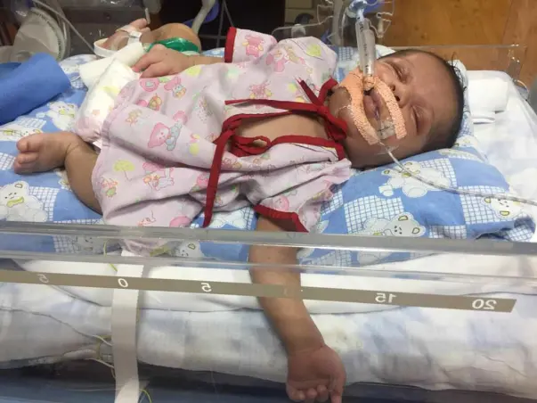 Help 25-days-old Baby Krishna Get Open Heart Surgery