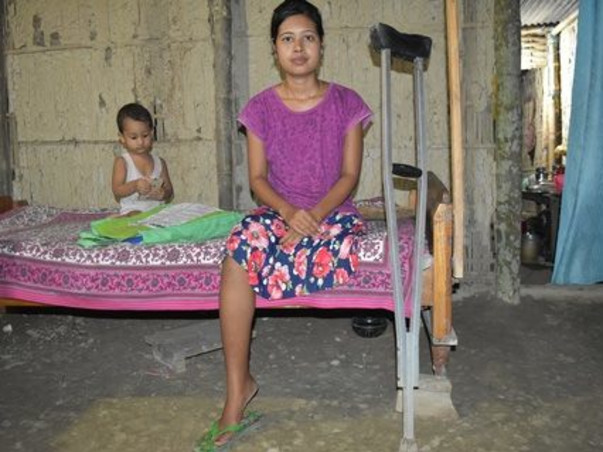 Help Jutika To Get Her Leg Back
