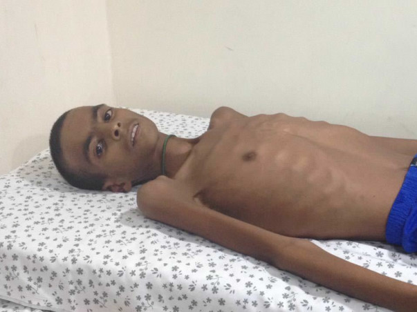 Help 16-year-old Shabaz recover from severe malnutrition