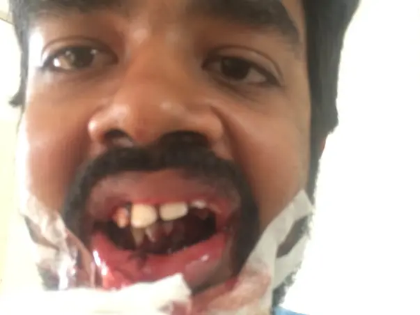 Help Vishnu To Put Smiles Back On Thousands Of Farmers And Kids