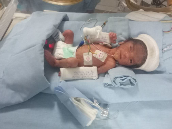 These Parents Are Struggling To Save Their Extremely Premature Baby